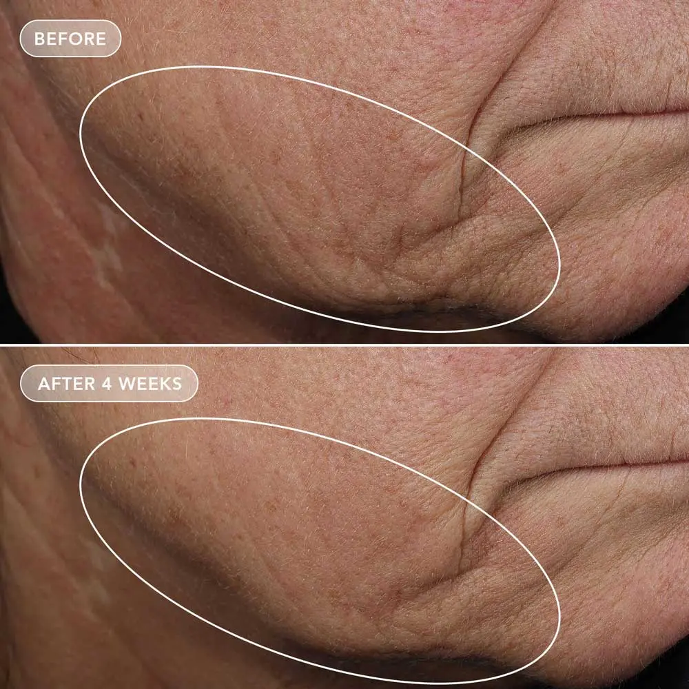 Image skincare VOL U LIFT™ 4D skin rebound complex ieu100 2
