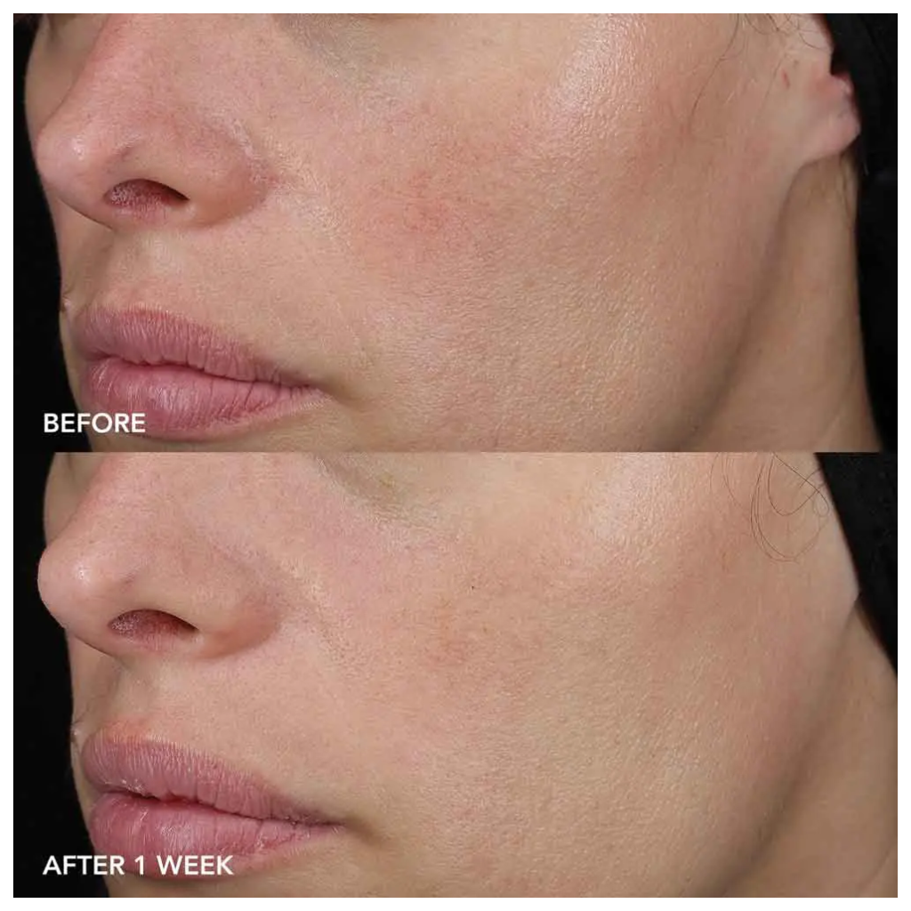 Image skincare md barrier repair recovery balm md128 4