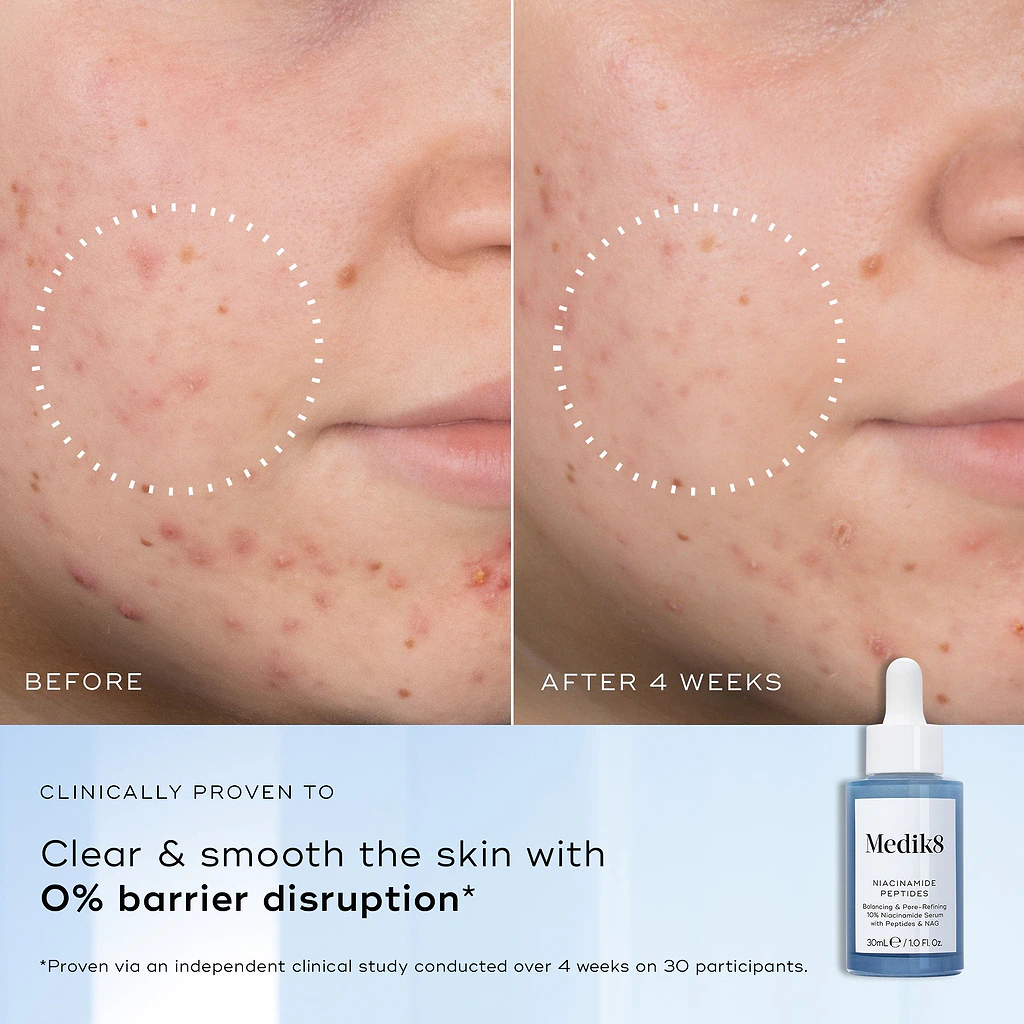 Medik8 niacinamide peptides 30ml p014523 4