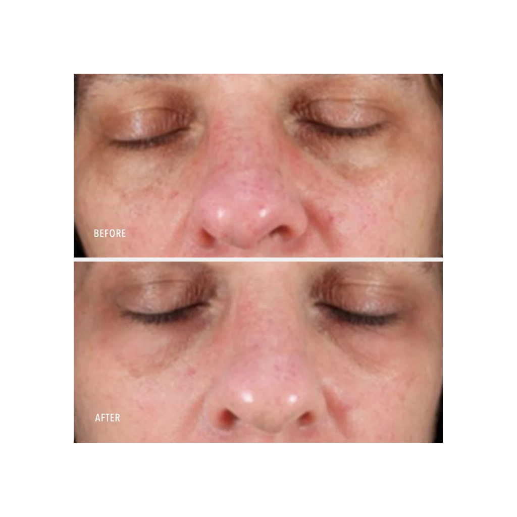 Hydropeptide collagen reactive pm 30ml 818951023746 3