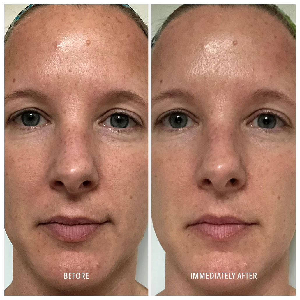 Hydropeptide polish plump peel 2x30ml 853666001542 3