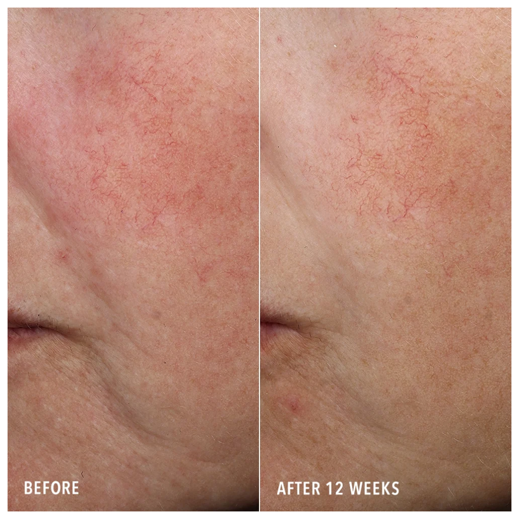 Hydropeptide synec cserum 30ml 818951024125 3
