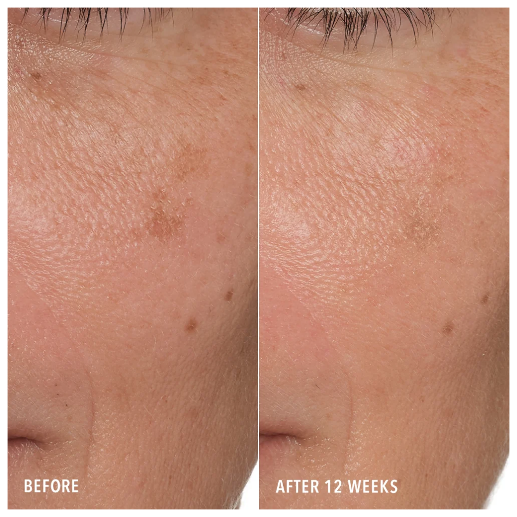 Hydropeptide synec cserum 30ml 818951024125 4