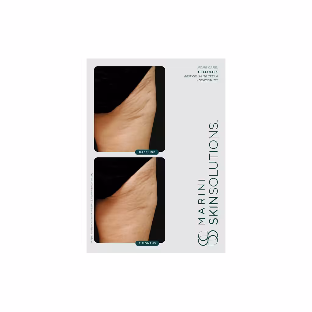 Marini skinsolutions cellulitx cellulite cream 119g nb1412 3