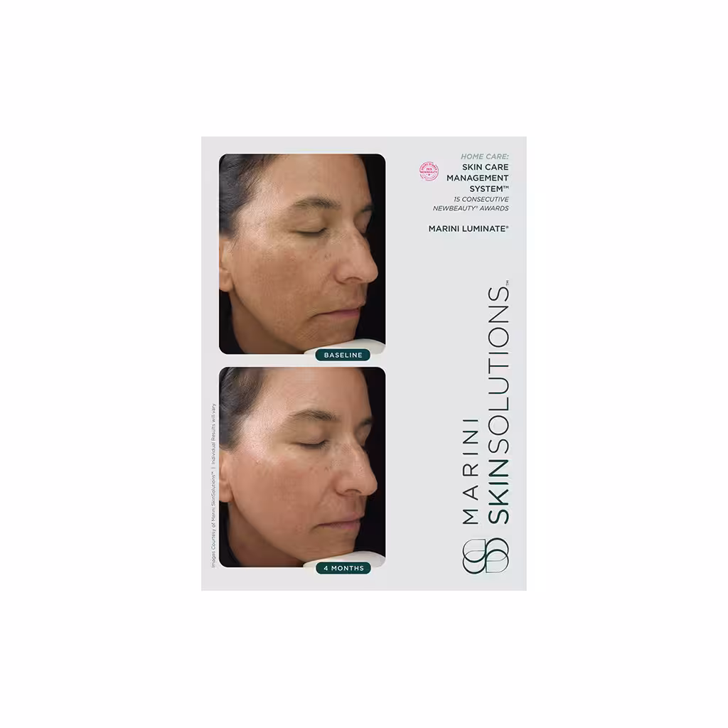 Marini skinsolutions marini luminate 30g ra1407 3