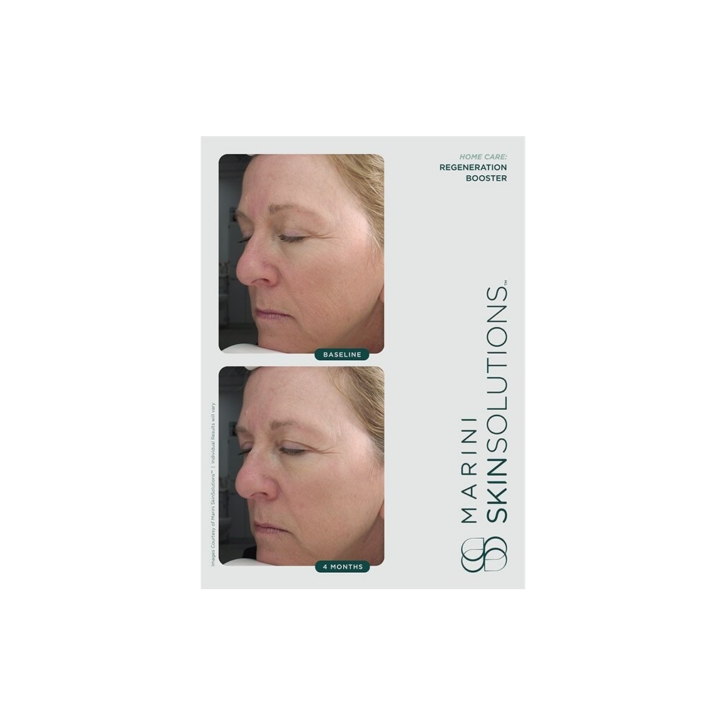 Marini skinsolutions regeneration booster 30ml gf0127 3