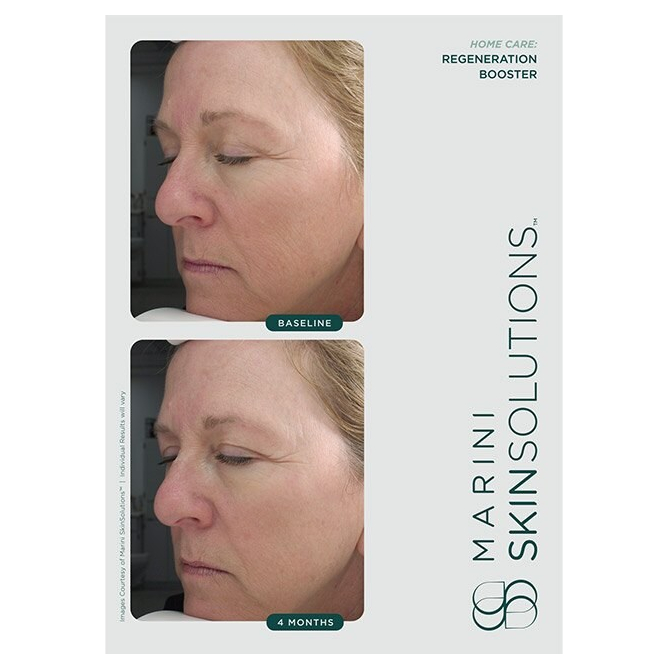 Marini skinsolutions regeneration booster 30ml gf0127 3