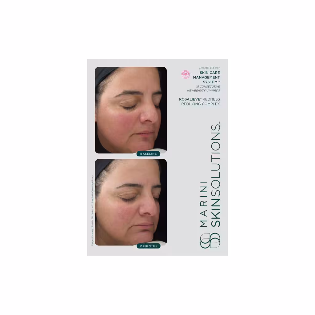 Marini skinsolutions rosalieve redness 30ml gf1408 3