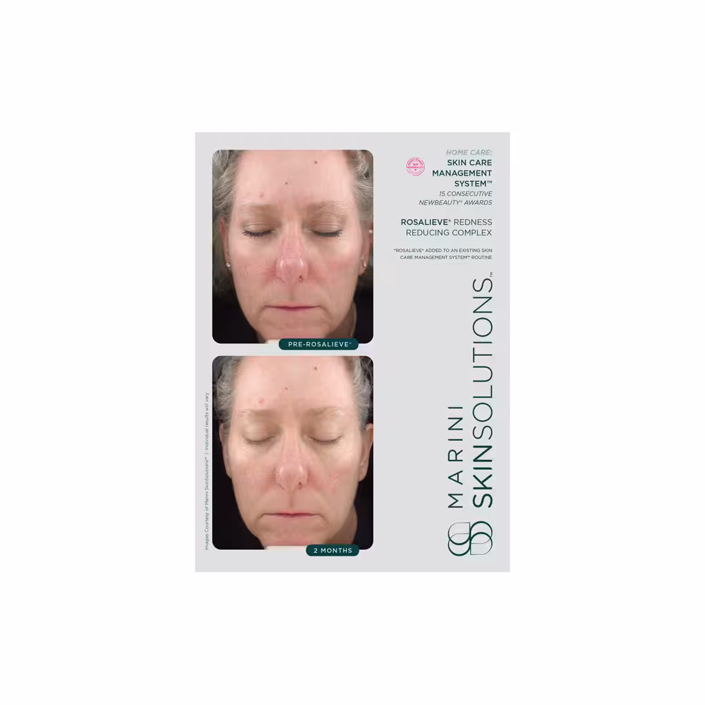 Marini skinsolutions rosalieve redness 30ml gf1408 4