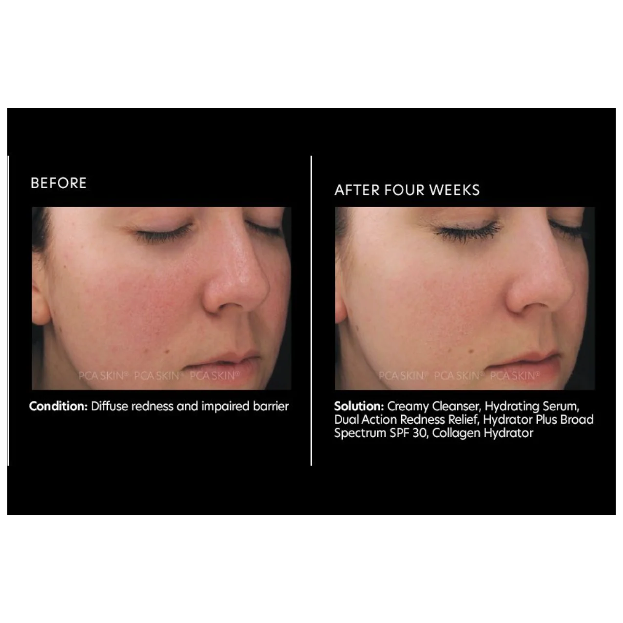 Dual Action Redness Relief - Pilt 4