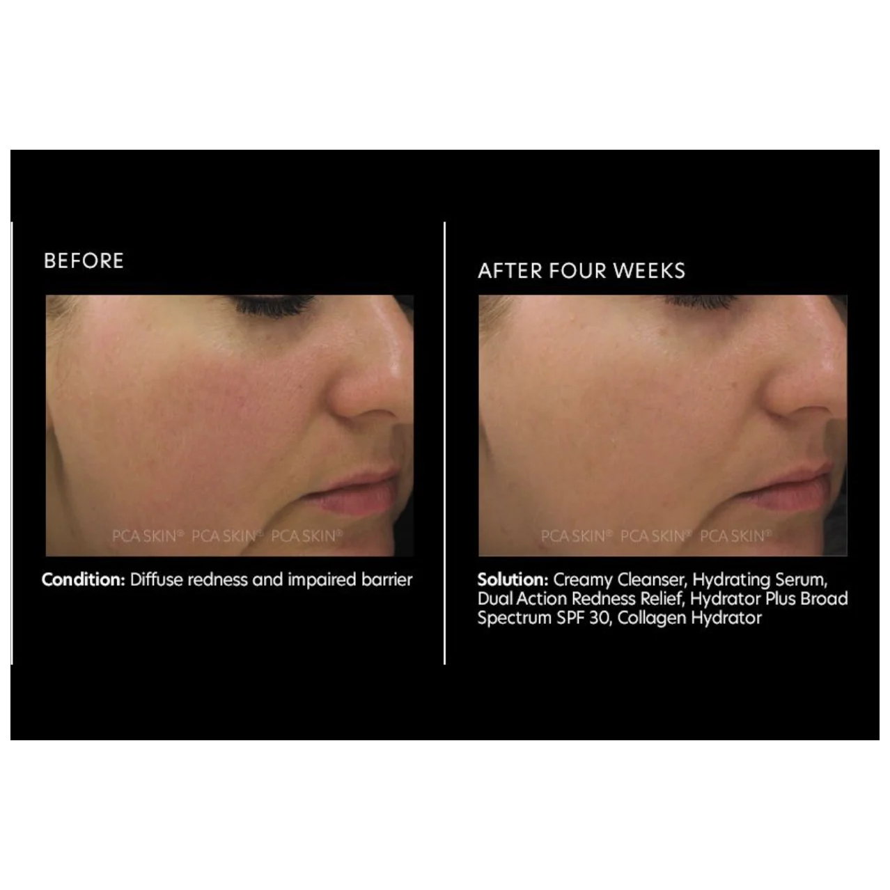 Dual Action Redness Relief - Pilt 5