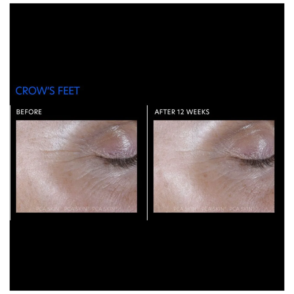 ExLinea Pro Peptide Serum - Pilt 3