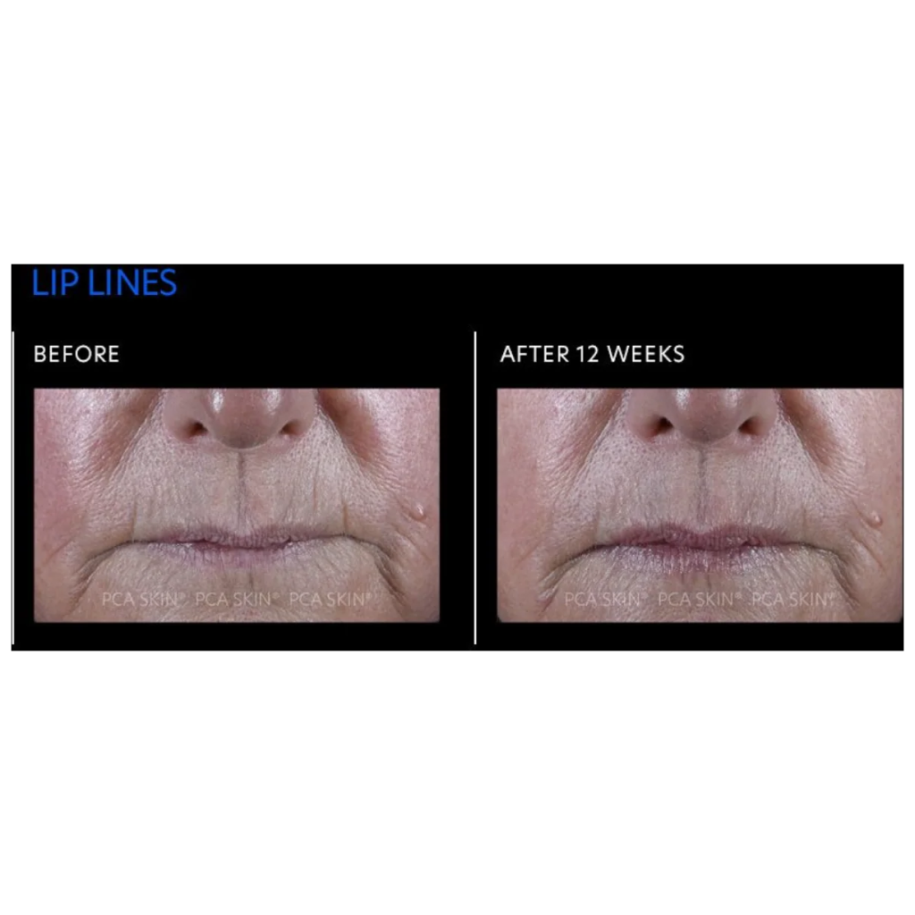 ExLinea Pro Peptide Serum - Pilt 4