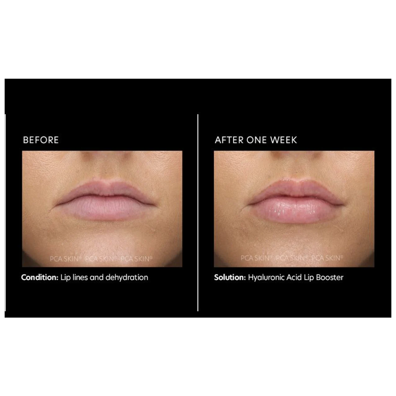 Hyaluronic Acid Lip Booster - Pilt 3