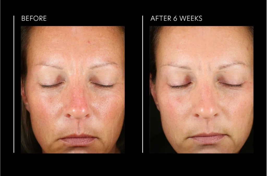 Pca skin hyaluronic acid overnight mask 51g 0812025019499 3
