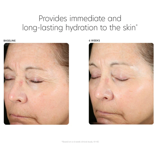 Hyaluronic Acid Boosting Serum - Pilt 3