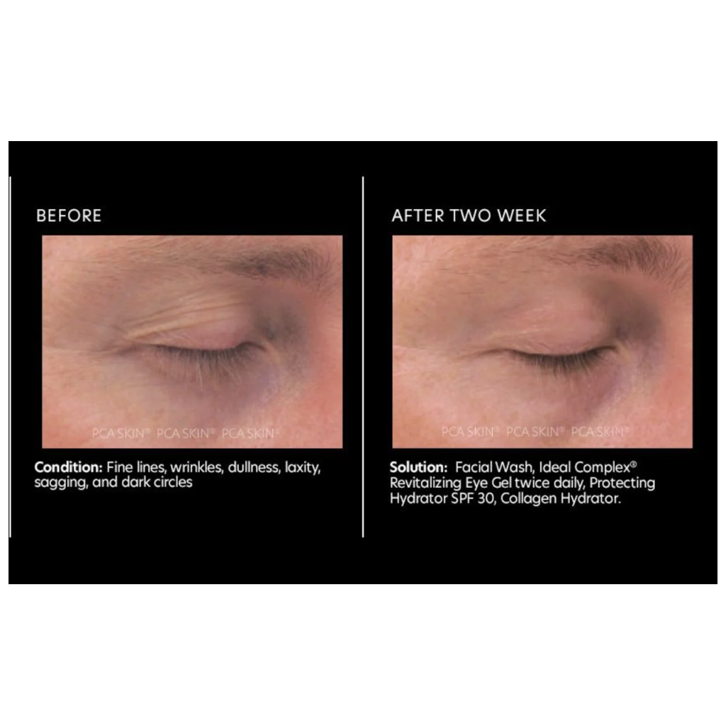 Ideal Complex Revitalizing Eye Gel - Pilt 3