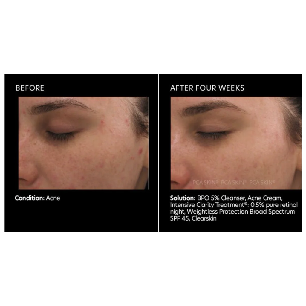 Intensive Clarity Treatment - Pilt 3