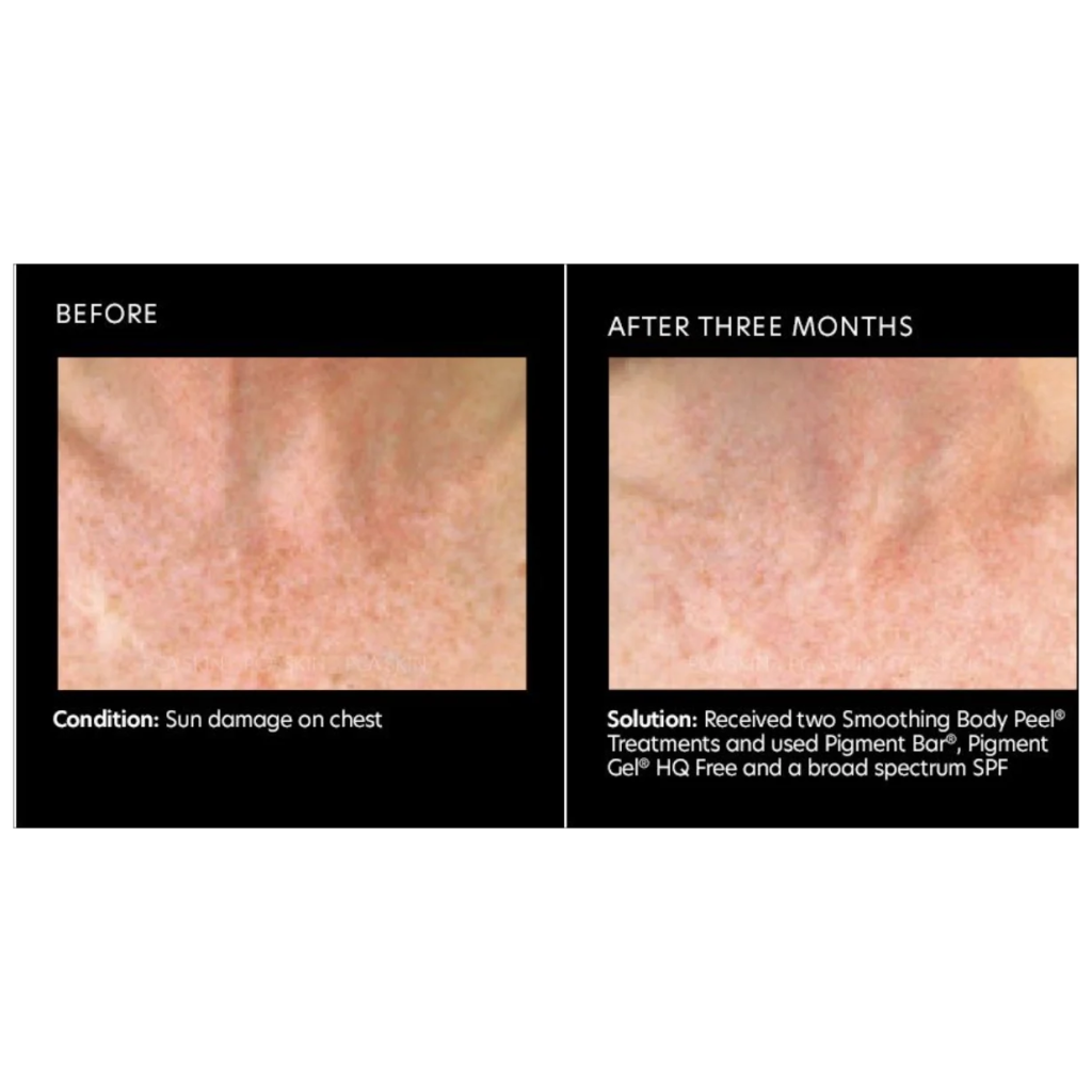 Pca skin pigment bar 90g 0812025010373 4