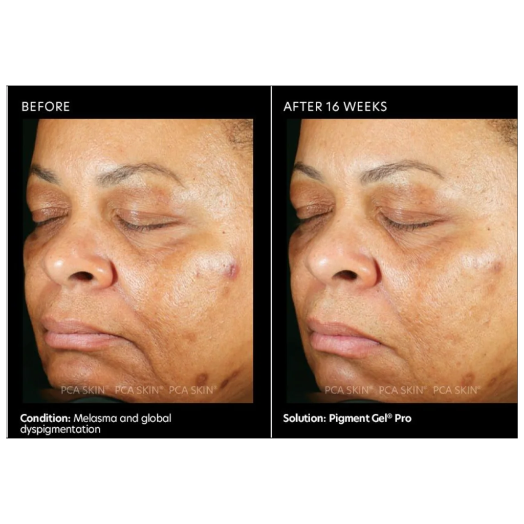Pigment Gel PRO - Pilt 2