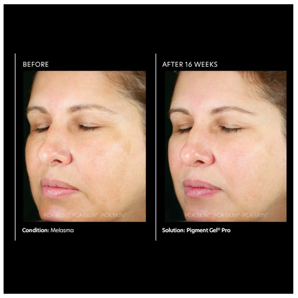 Pigment Gel PRO - Pilt 3