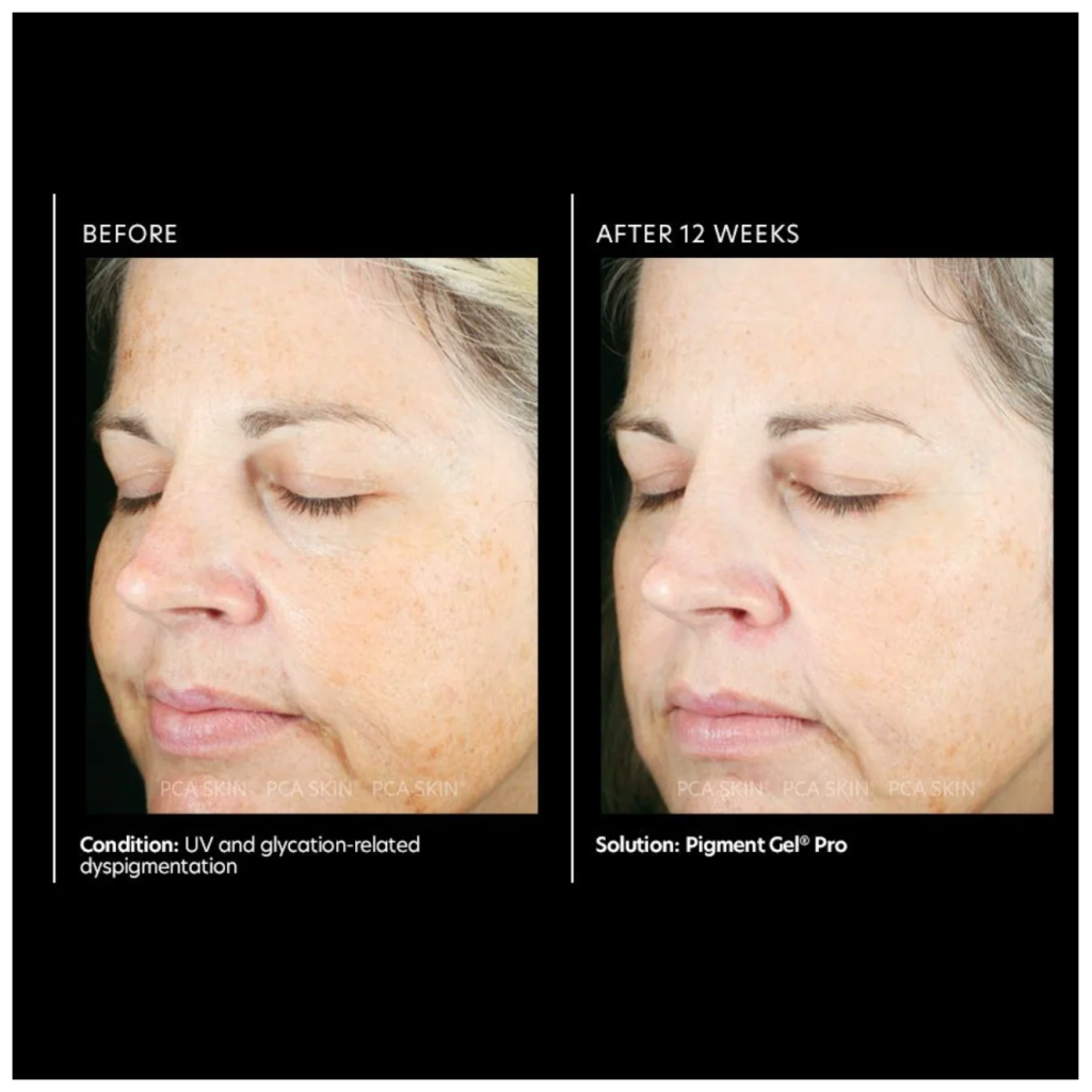 Pigment Gel PRO - Pilt 4