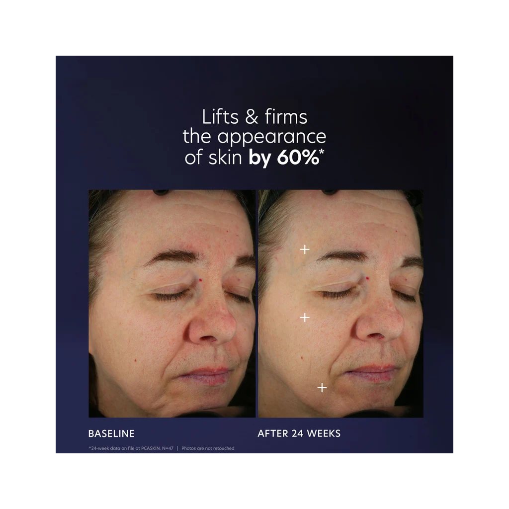 Pro – Max Age Renewal - Pilt 3