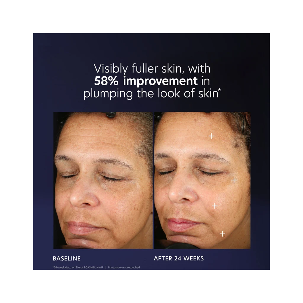 Pro – Max Age Renewal - Pilt 5