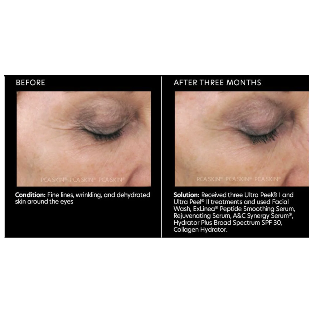 Rejuvenating Serum - Pilt 4