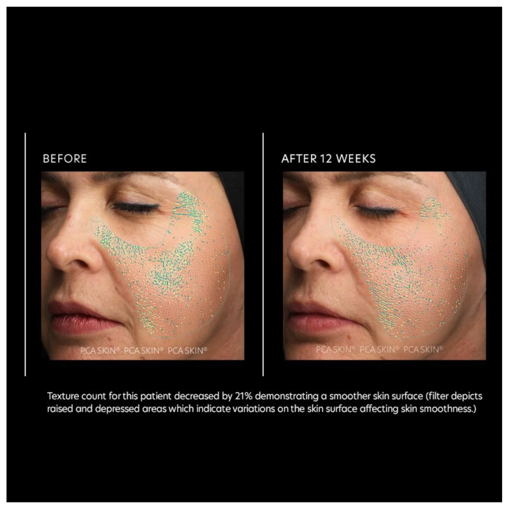 Resurfacing Serum - Pilt 3