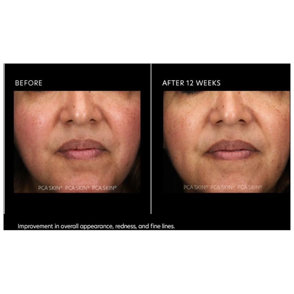 Resurfacing Serum - Pilt 4