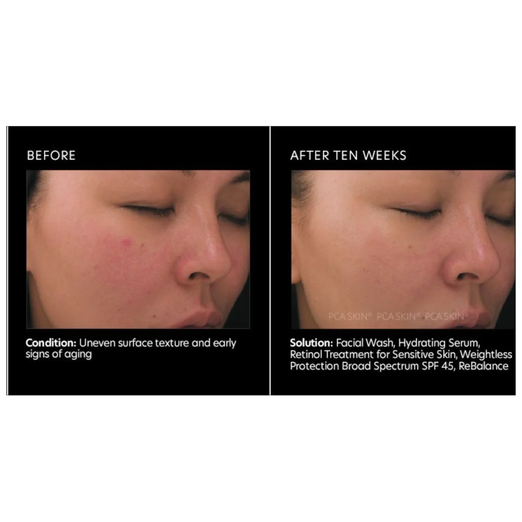Retinol Treatment for Sensitive Skin - Pilt 3