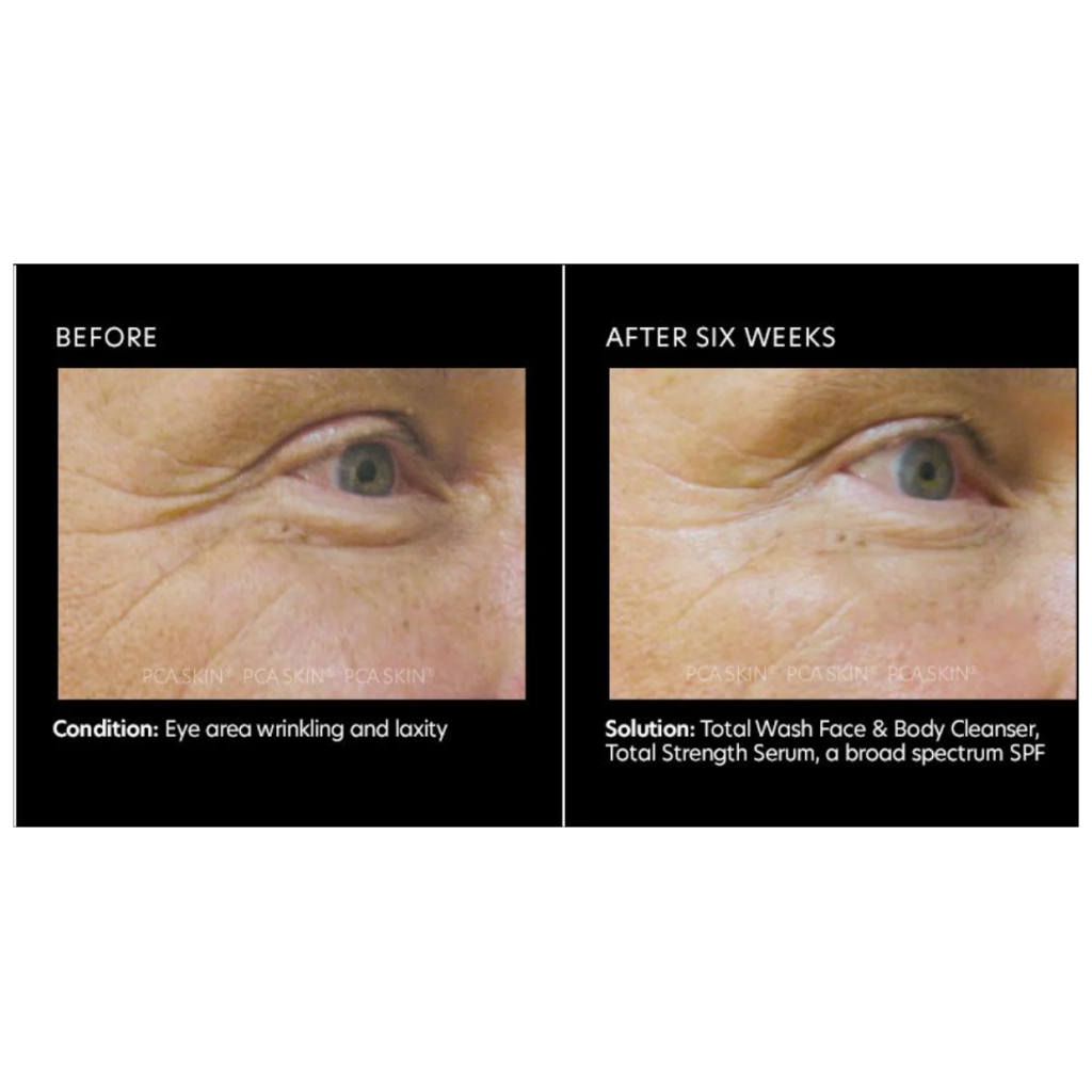 Total Strenght Serum - Pilt 4
