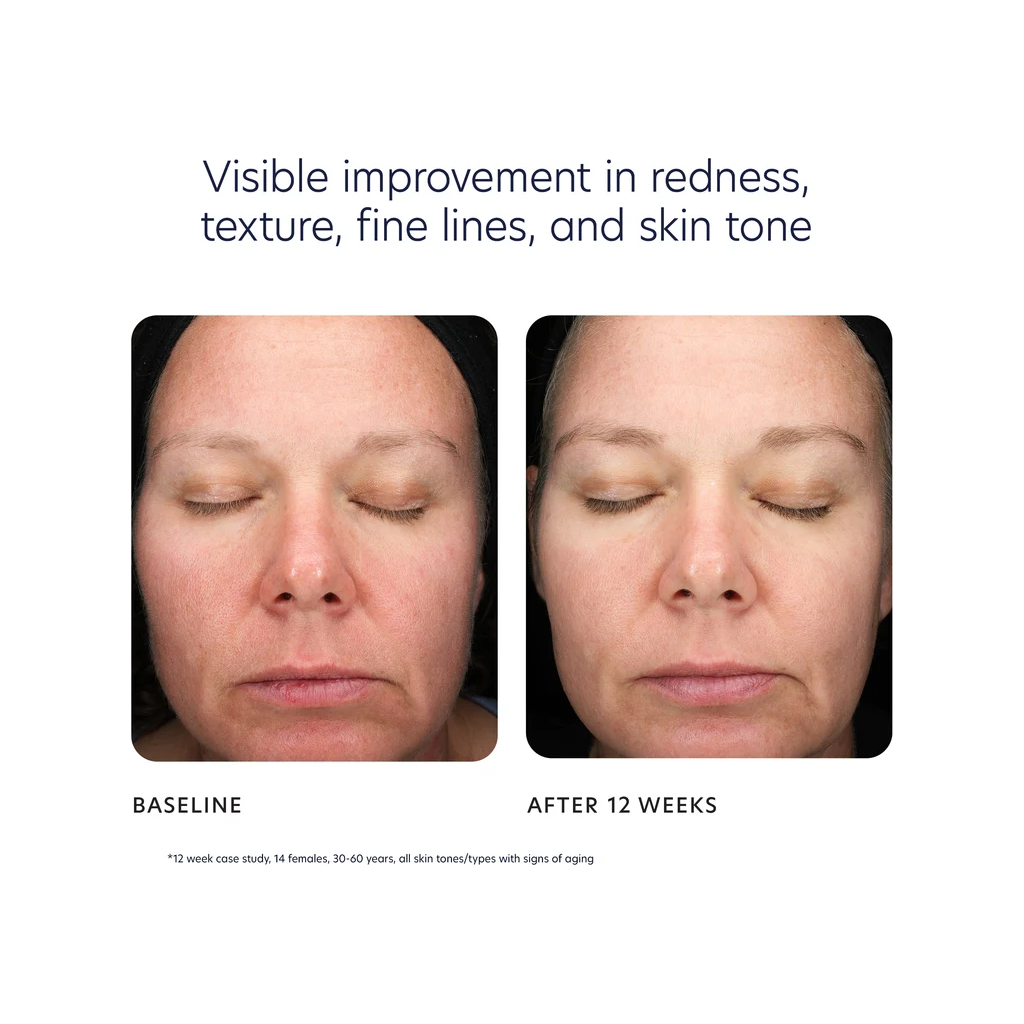 Pca skin triple exfoliation peel pads 30pads 23301 3 1