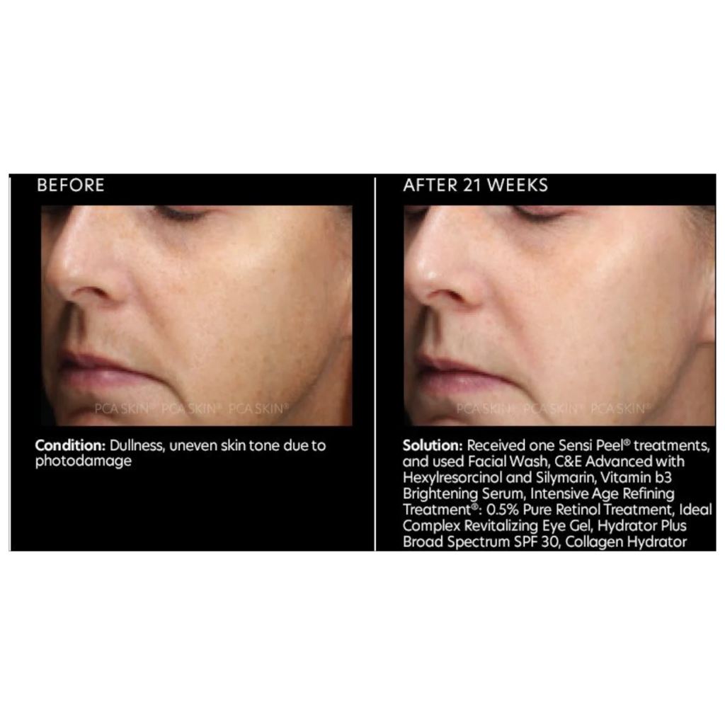 Vitamin B3 Brightening Serum - Pilt 4